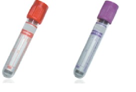 Cryoglobulins